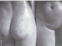 Le vaginisme ou le langage du corps. Le vaginisme ou le langage du corps.