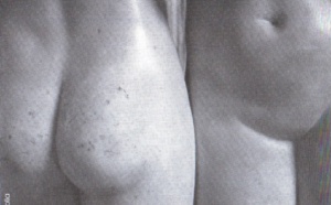 Le vaginisme ou le langage du corps. Le vaginisme ou le langage du corps.